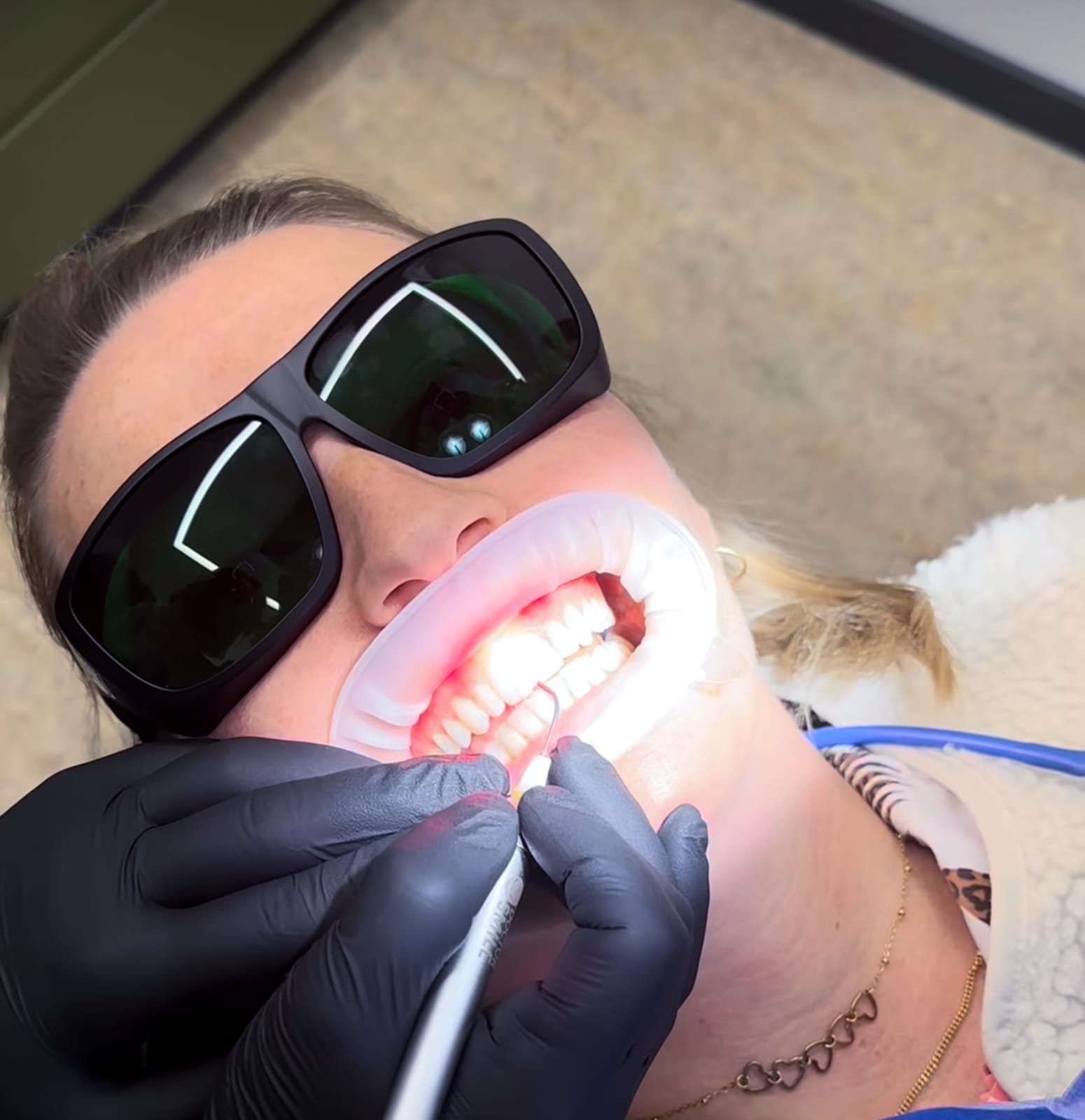 Laserbehandlung Parodontitis